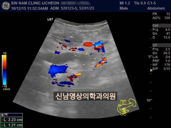 a91aa93529db81accb78722c2d5bfa6b_1757902